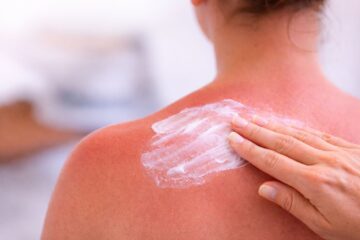 Skóra zaczerwieniona po słońcu i chłodny, kojący kadr w letnim świetle - subtelne skojarzenie z oparzeniem słonecznym i pierwszą pomocą dla skóry